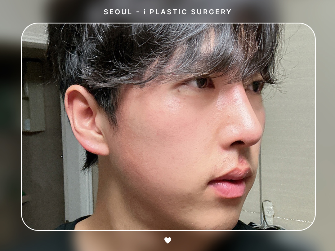 리얼셀카이미지