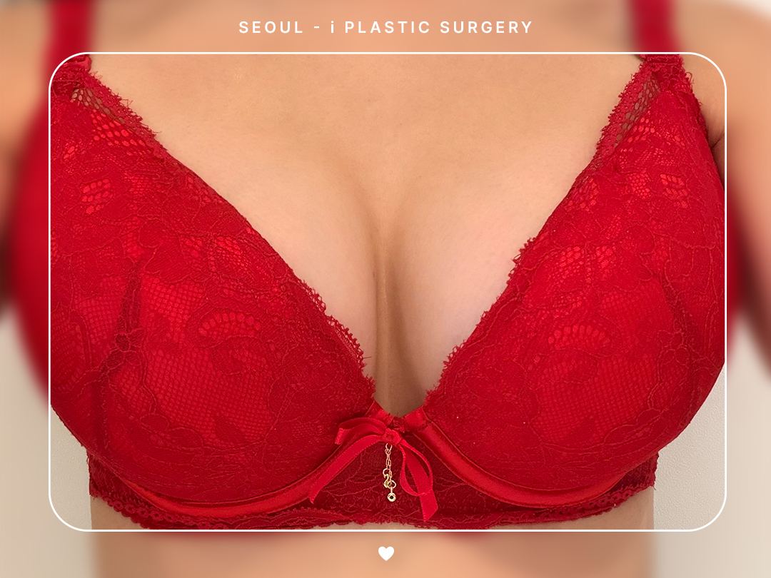 리얼셀카이미지