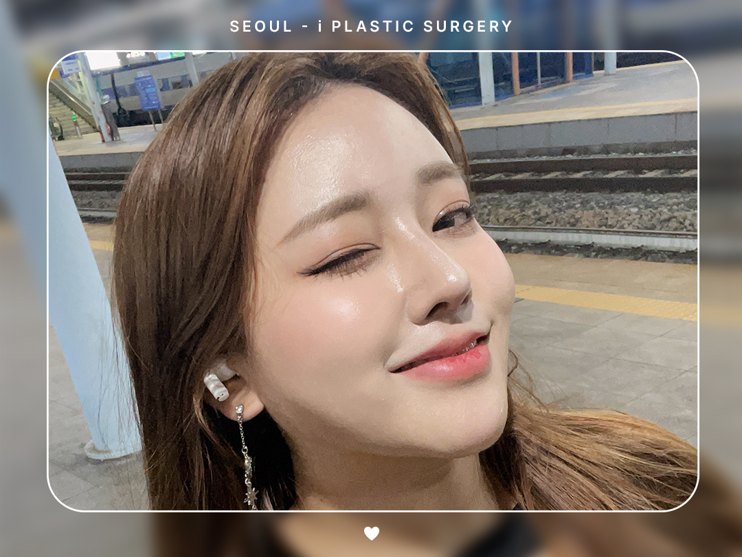 #코끝교정 #복코교정 #매부리코교정