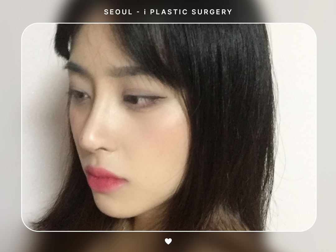 리얼셀카이미지