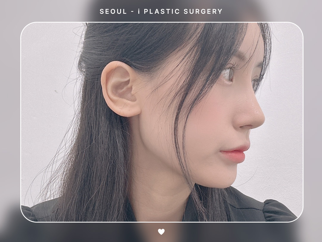 리얼셀카이미지
