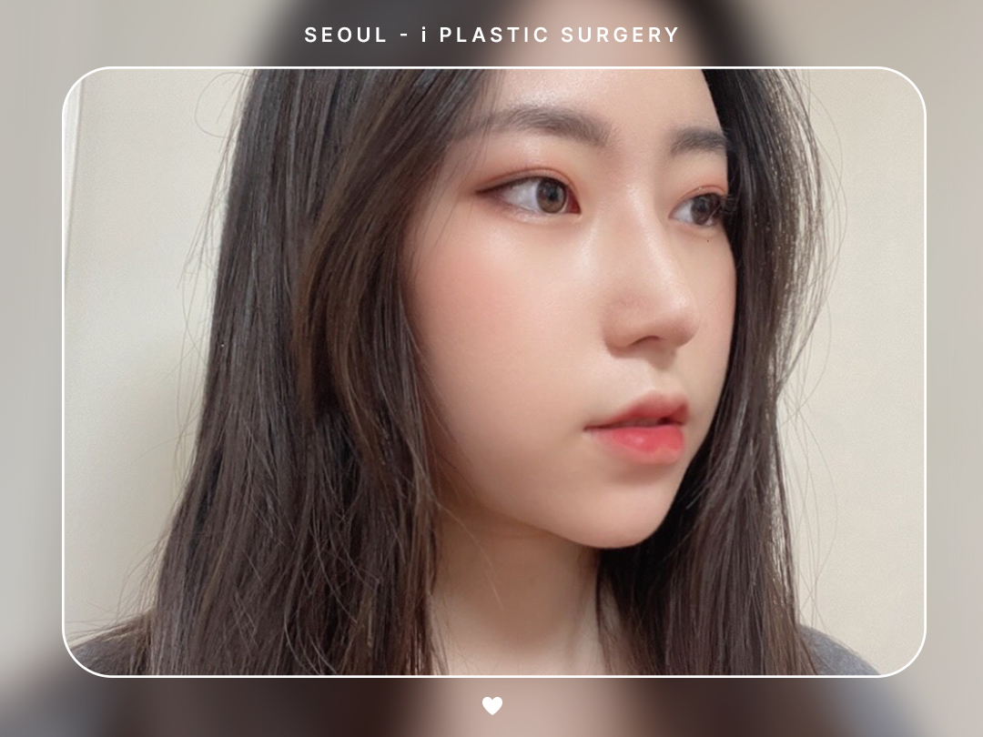 리얼셀카이미지