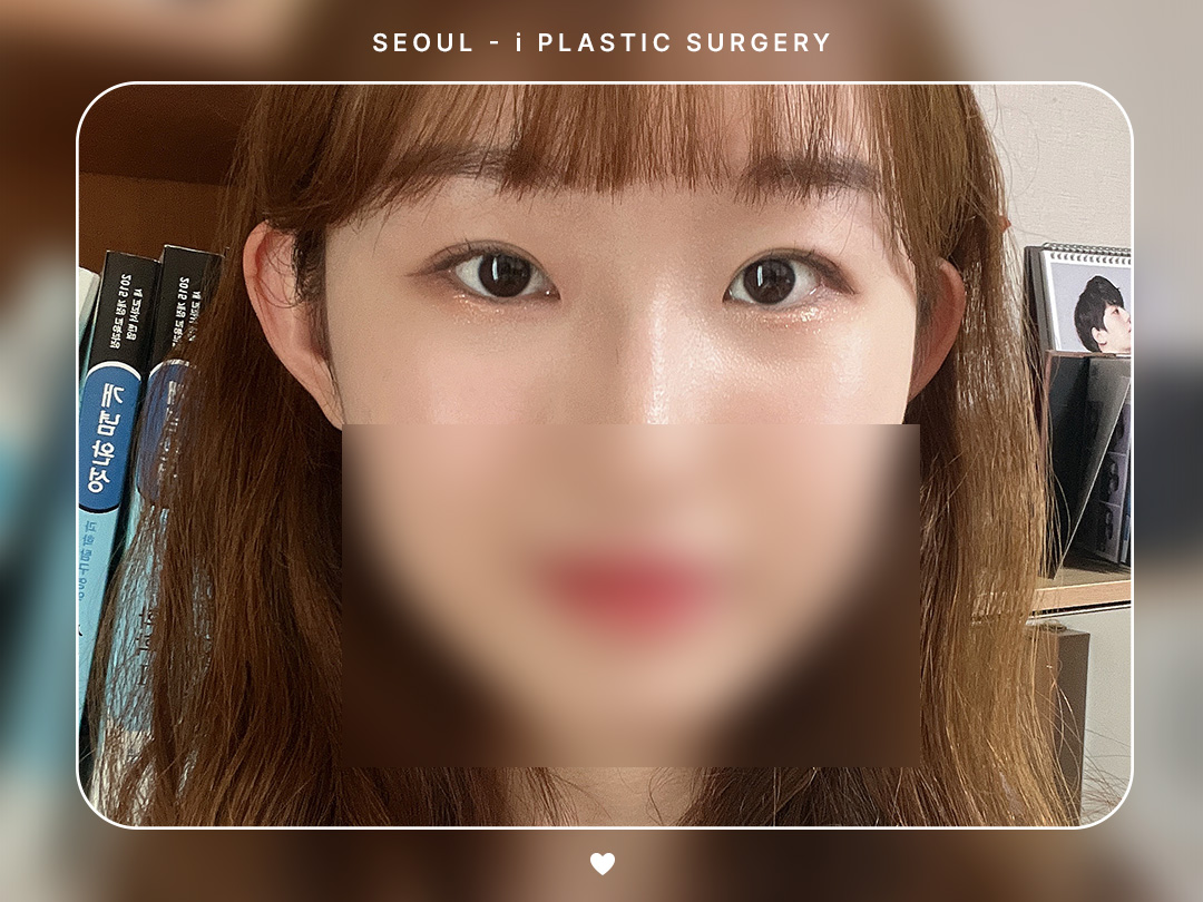리얼셀카이미지