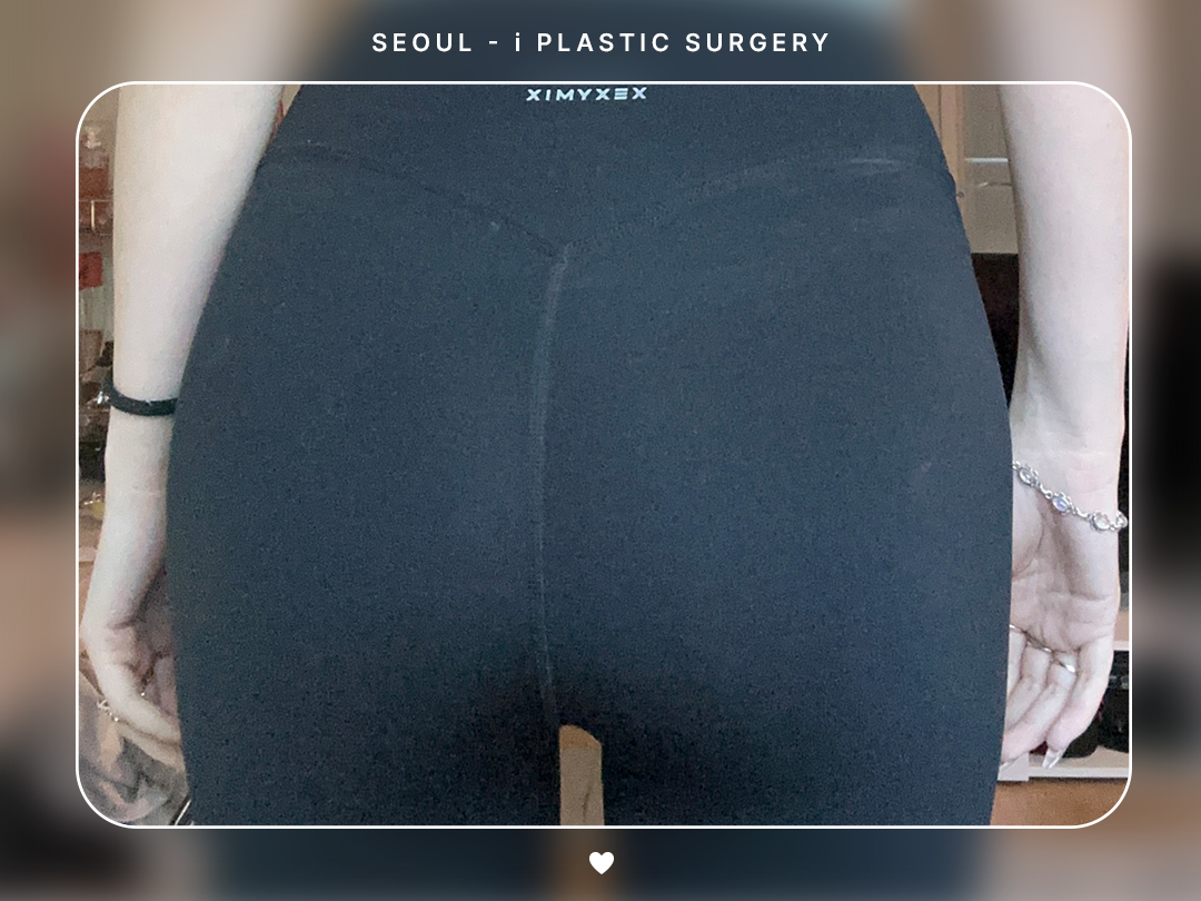리얼셀카이미지