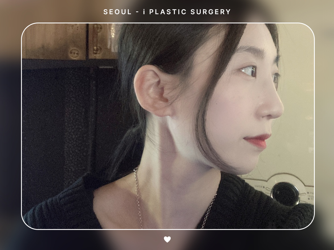 리얼셀카이미지
