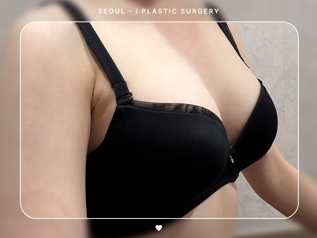 리얼셀카이미지