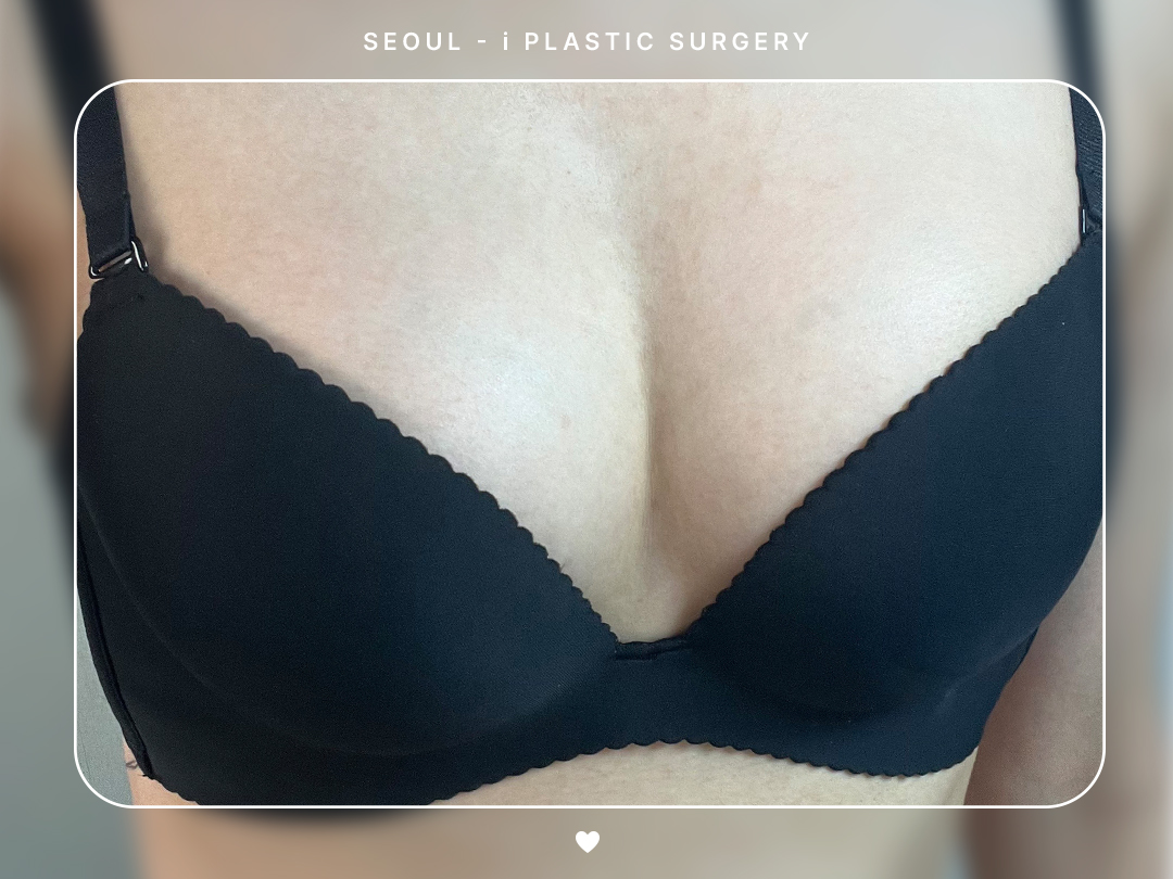 리얼셀카이미지