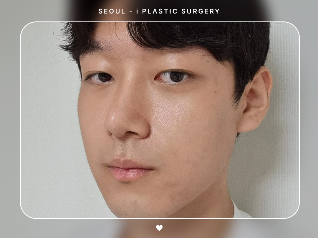 리얼셀카이미지