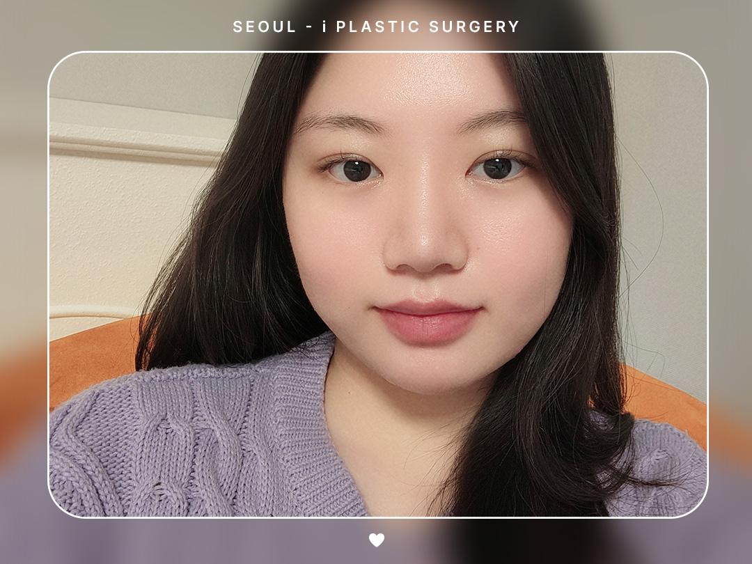 리얼셀카이미지