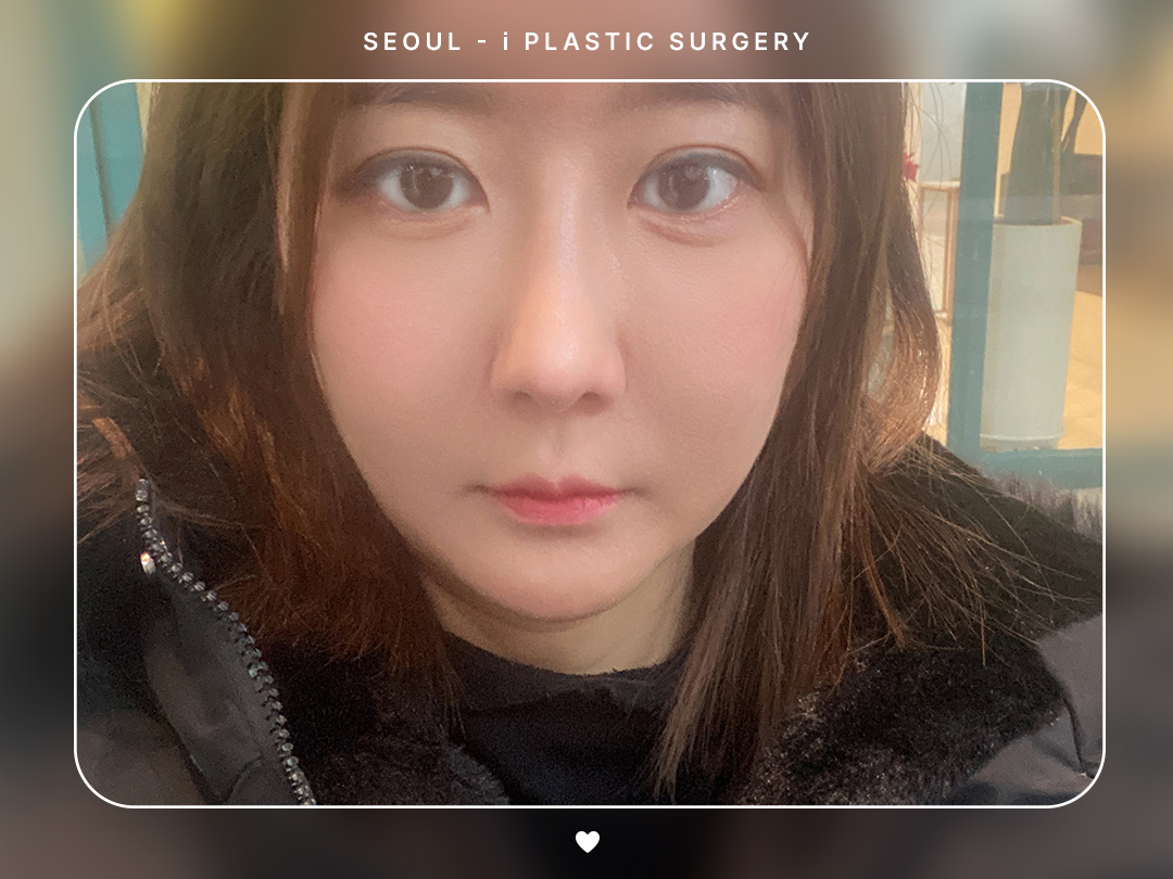 리얼셀카이미지