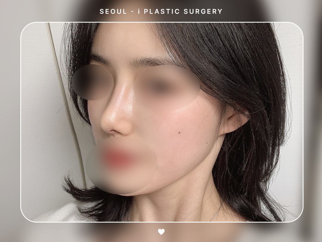 리얼셀카이미지