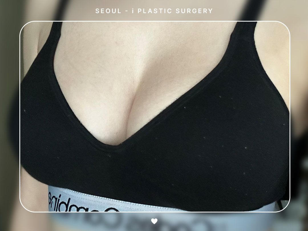 리얼셀카이미지