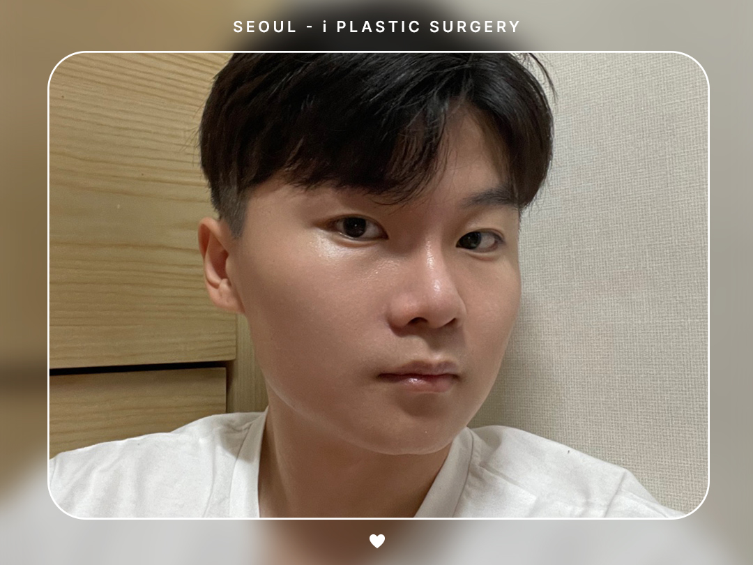 리얼셀카이미지