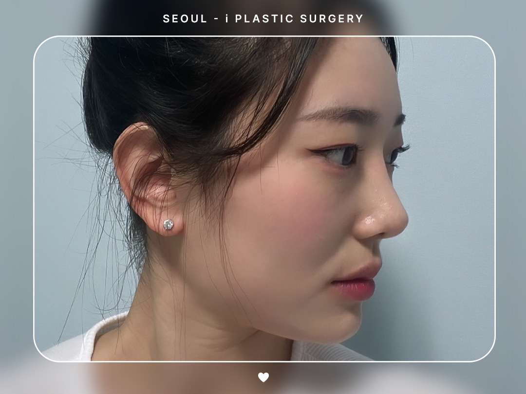 리얼셀카이미지