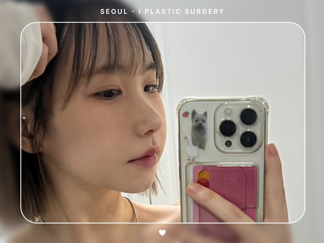 #콧대교정 #코끝교정