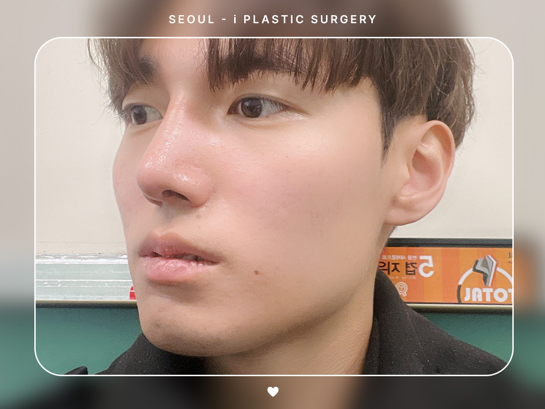 리얼셀카이미지