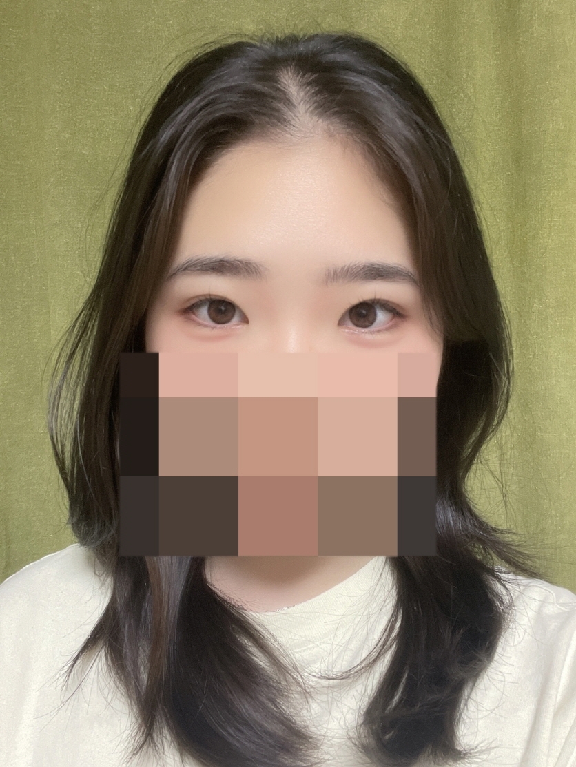 수술후기이미지