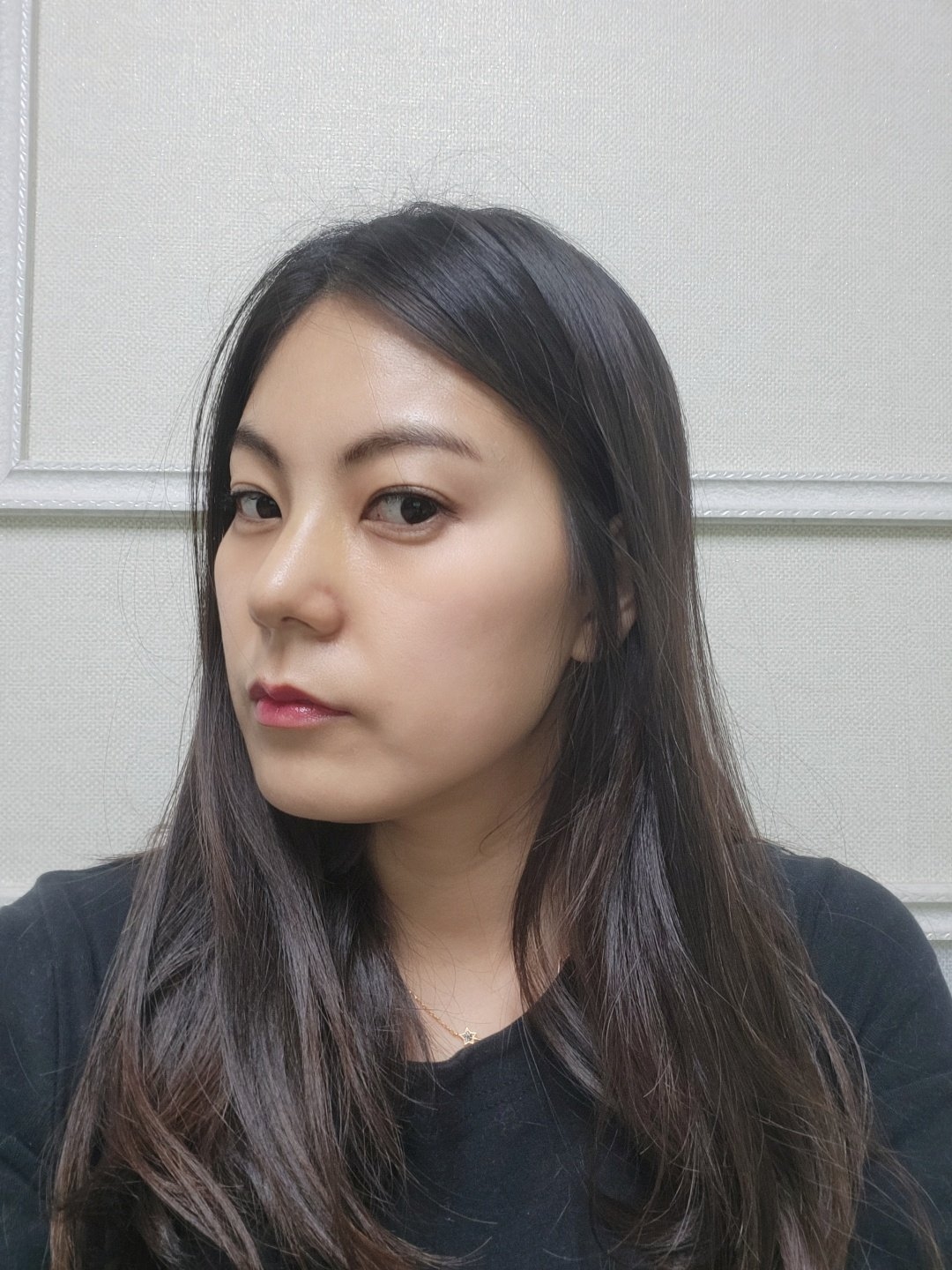 수술후기이미지