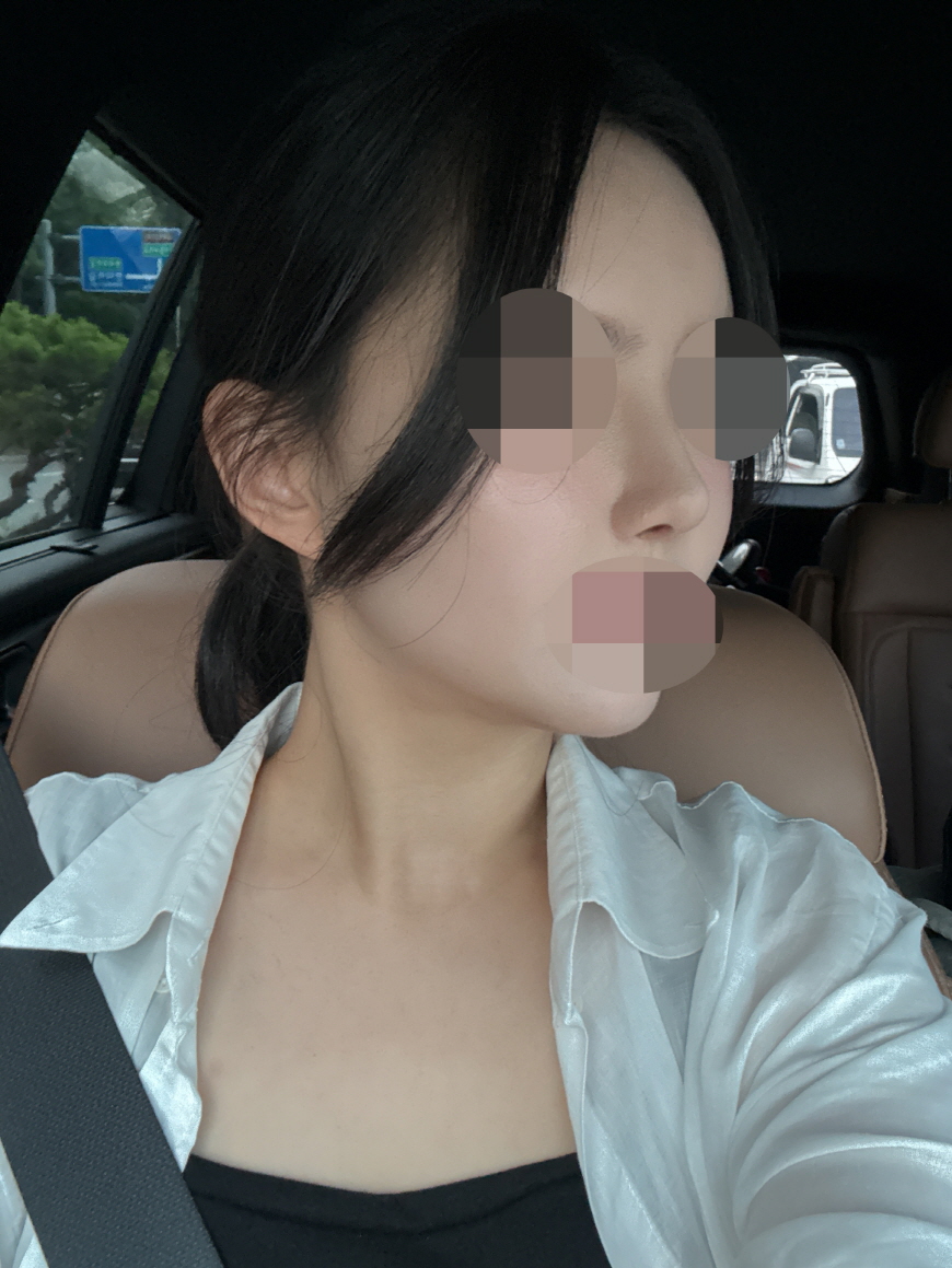 수술후기이미지