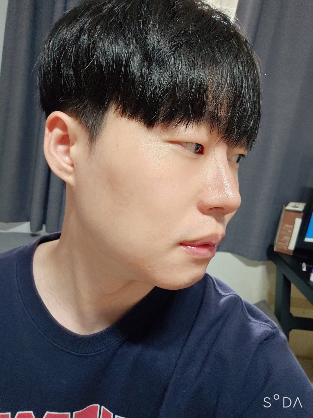 수술후기이미지