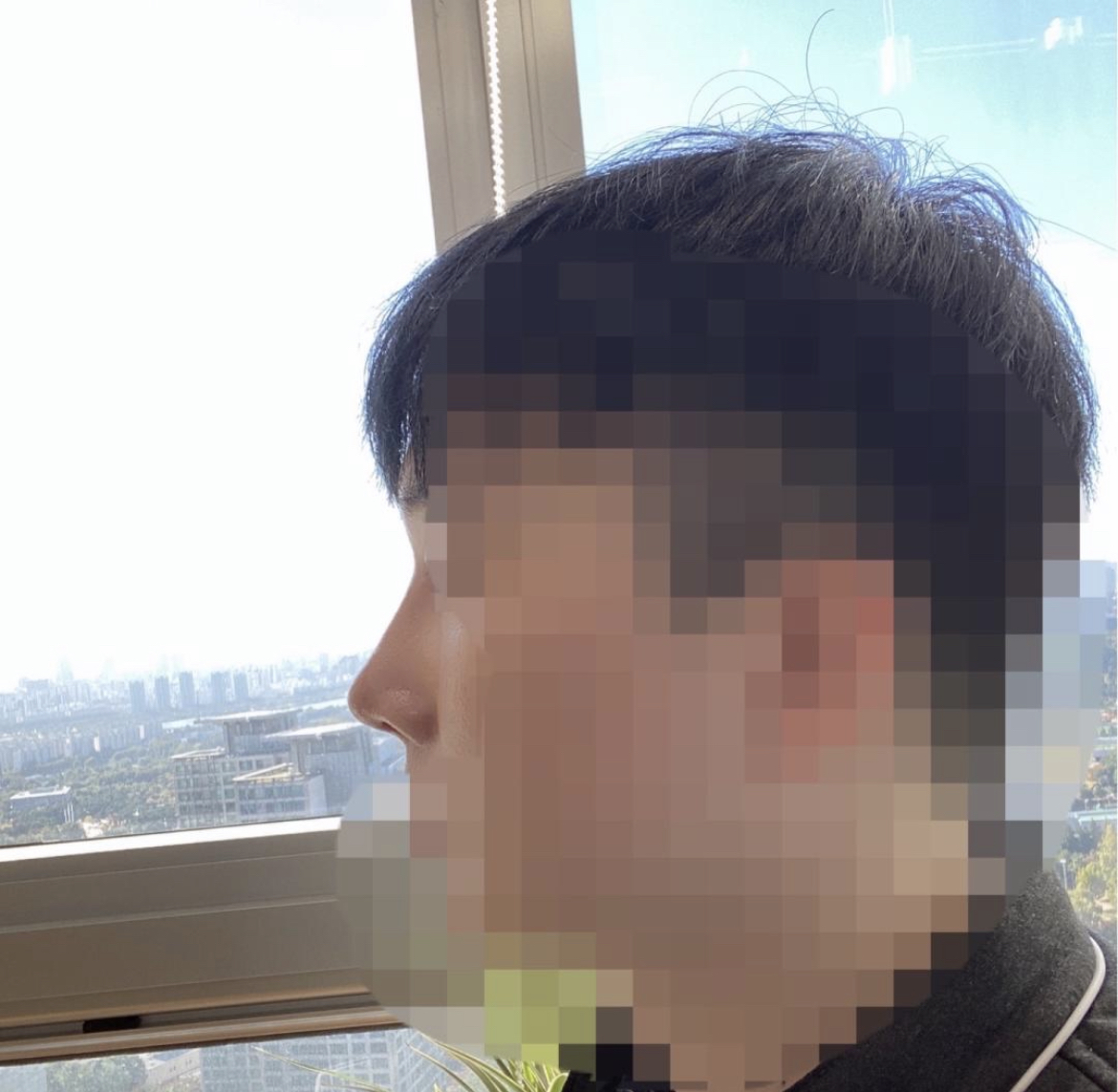 수술후기이미지