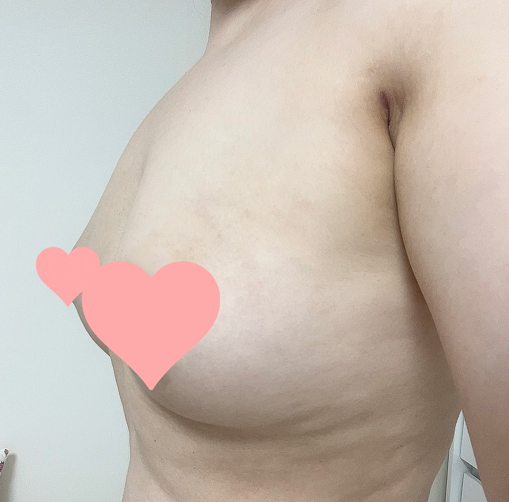 수술후기이미지