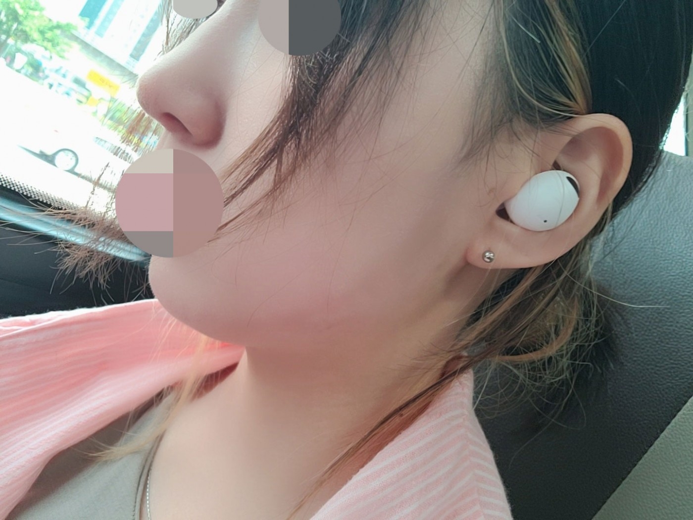 수술후기이미지