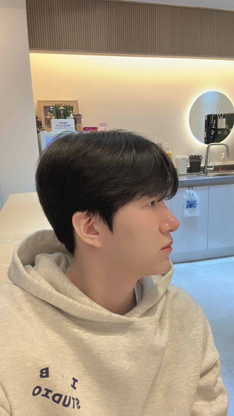 수술후기이미지