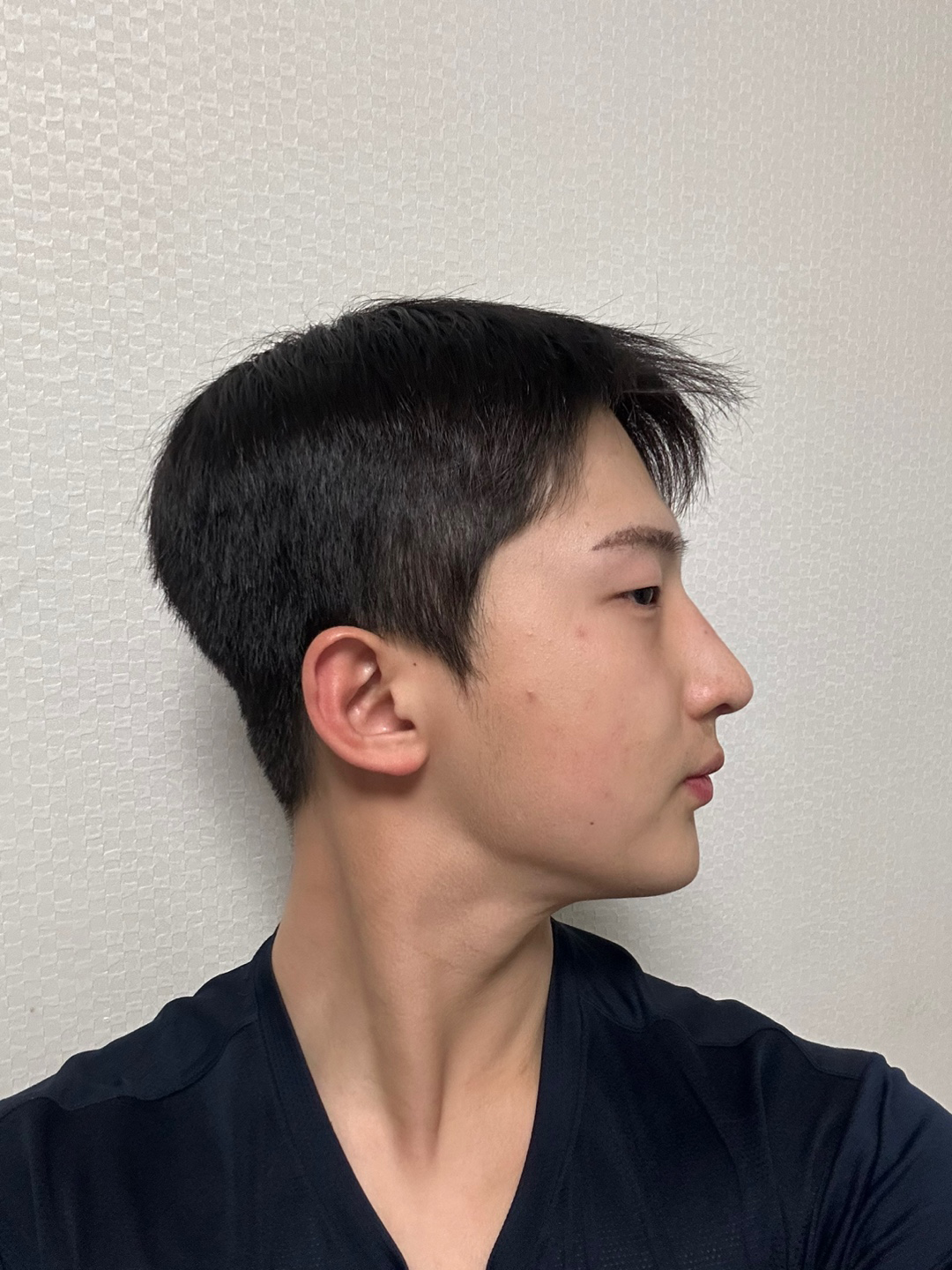 수술후기이미지