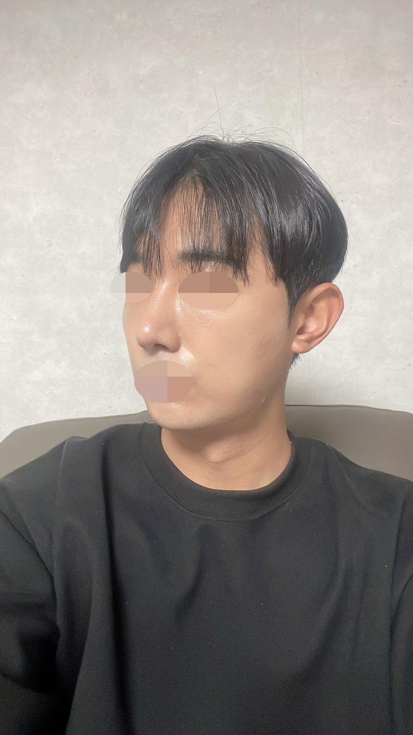 수술후기이미지