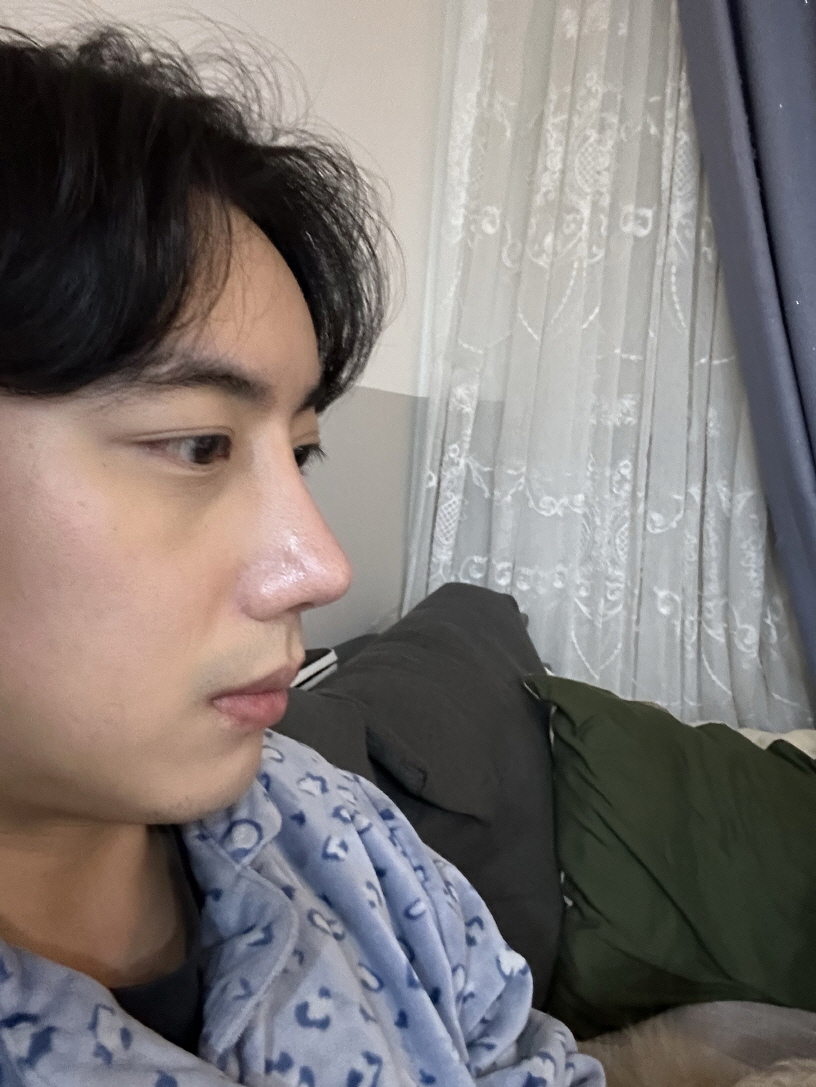 수술후기이미지