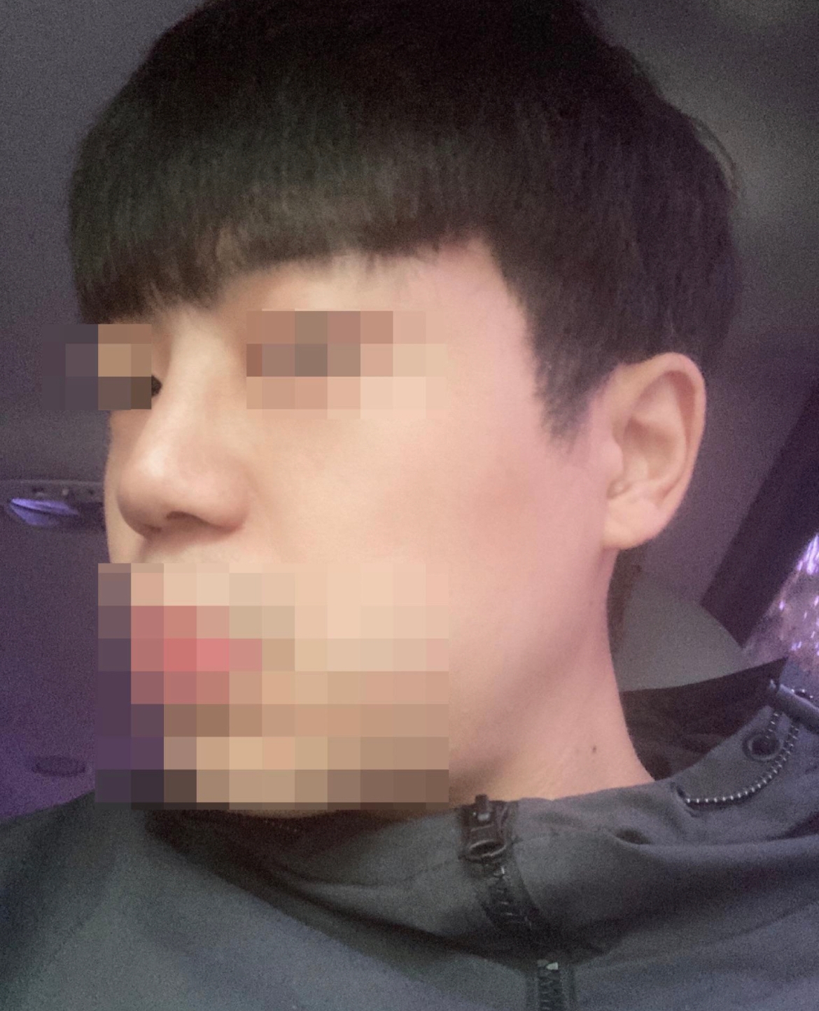 수술후기이미지