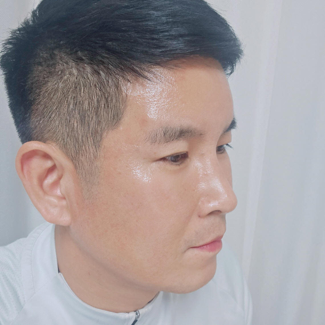 수술후기이미지