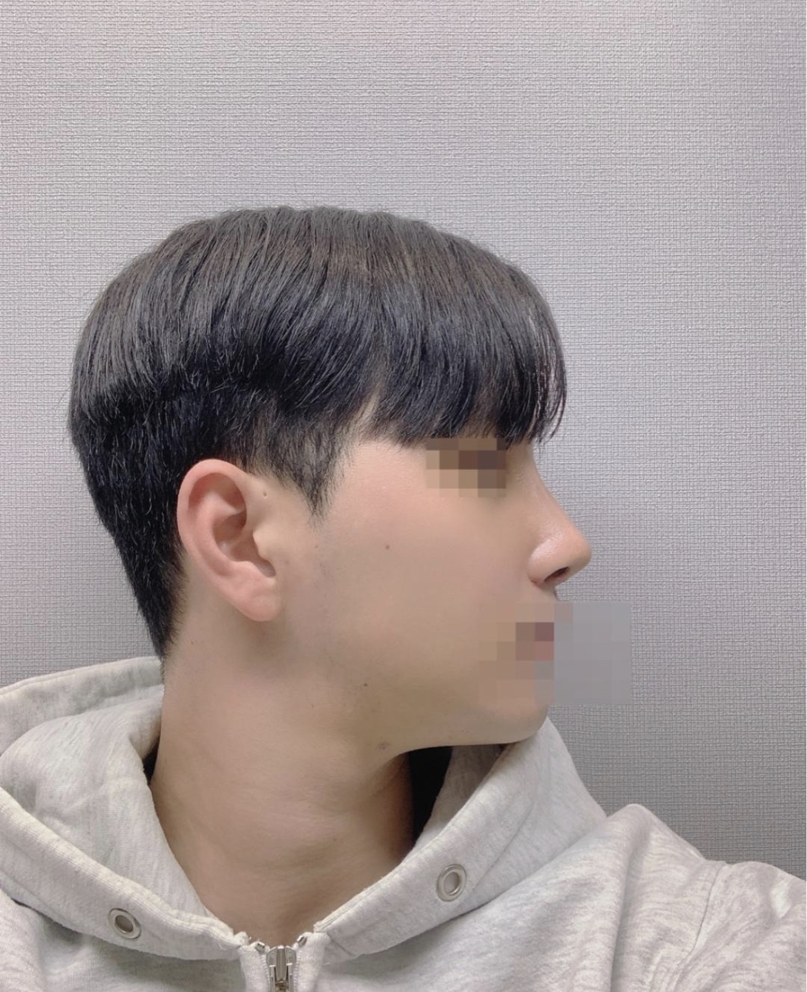 수술후기이미지