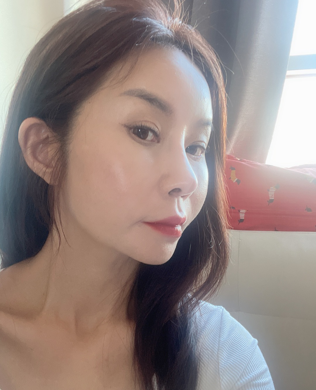 수술후기이미지