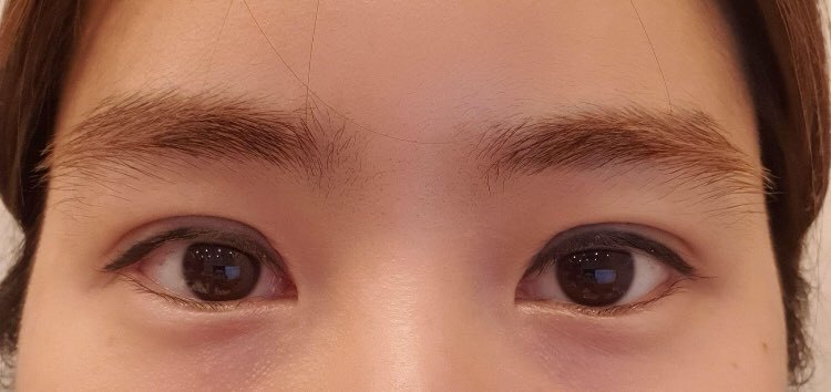 수술후기이미지