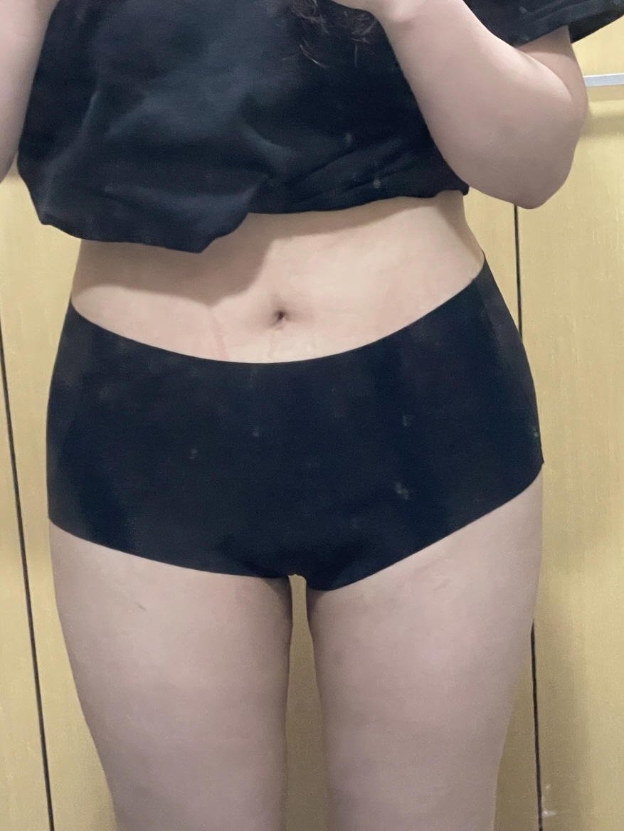 수술후기이미지