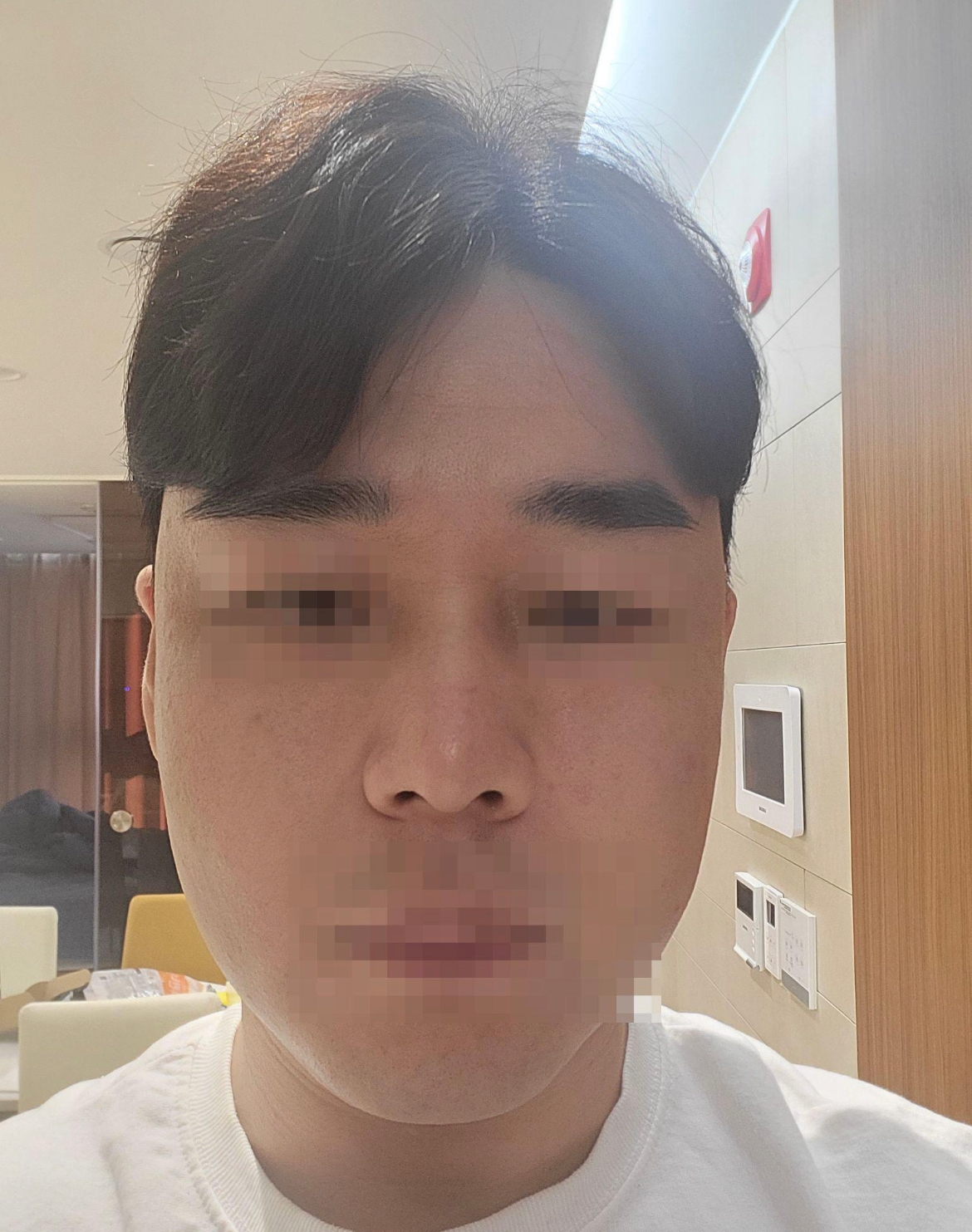 수술후기이미지