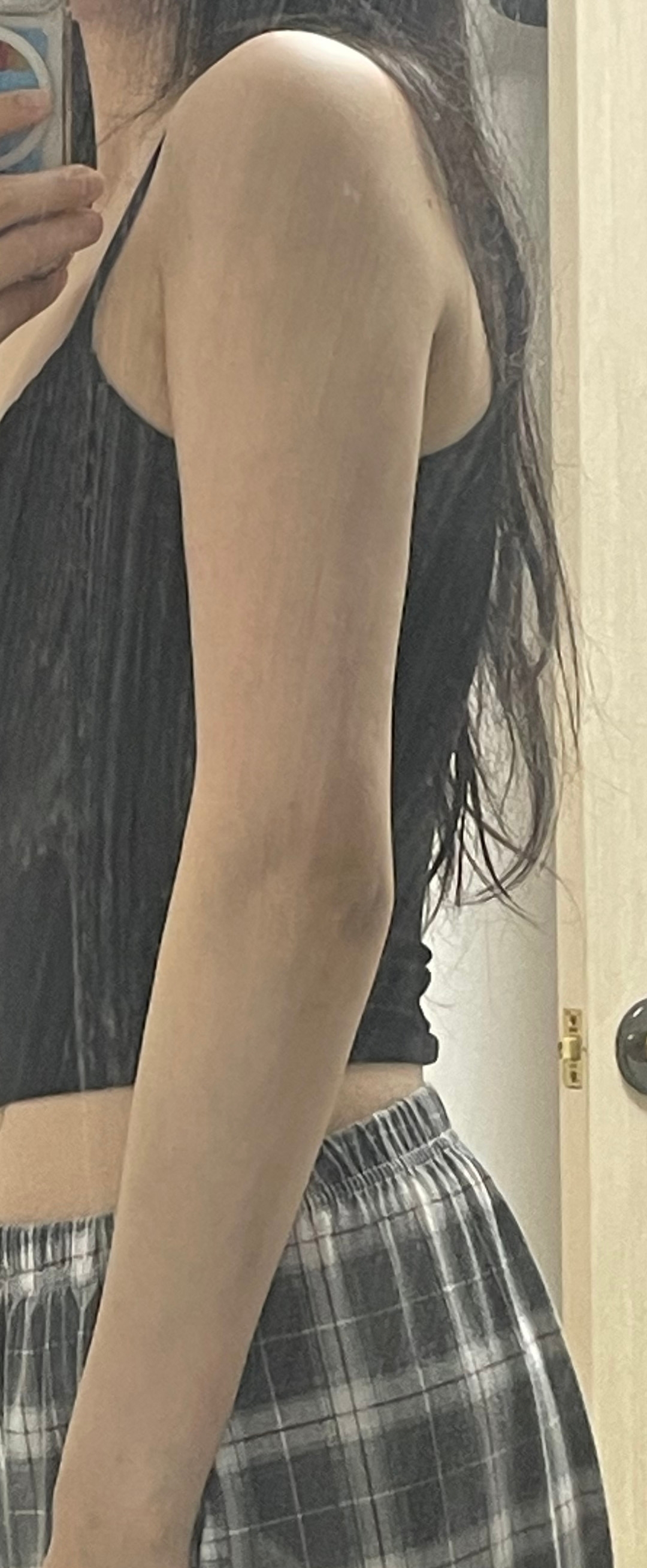 수술후기이미지