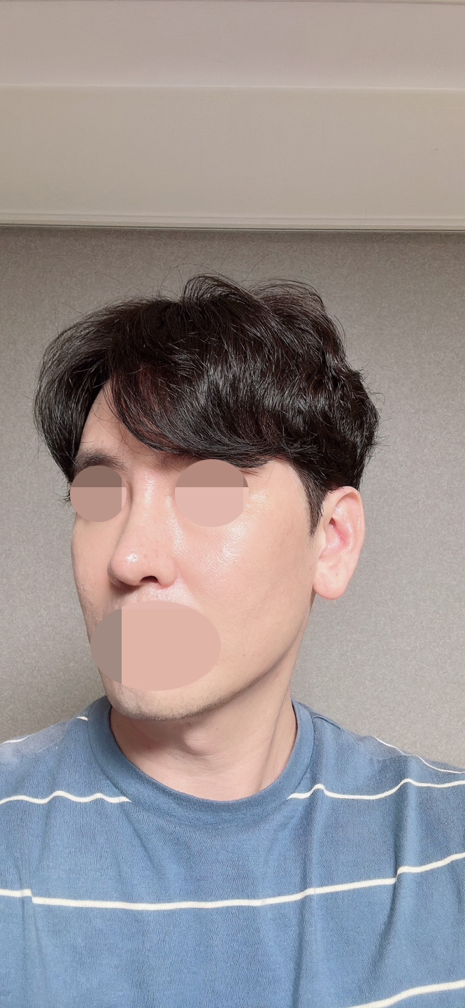 수술후기이미지