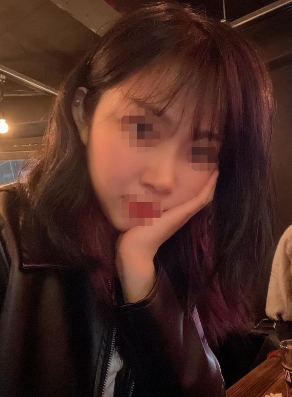 수술후기이미지