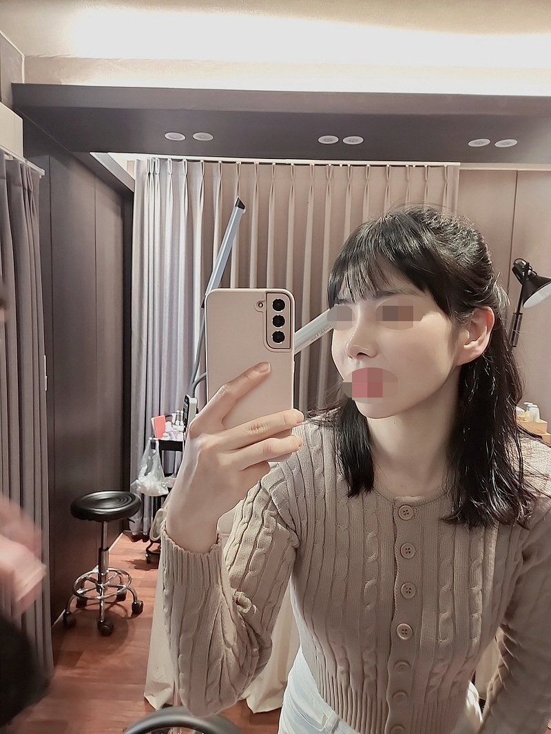 수술후기이미지