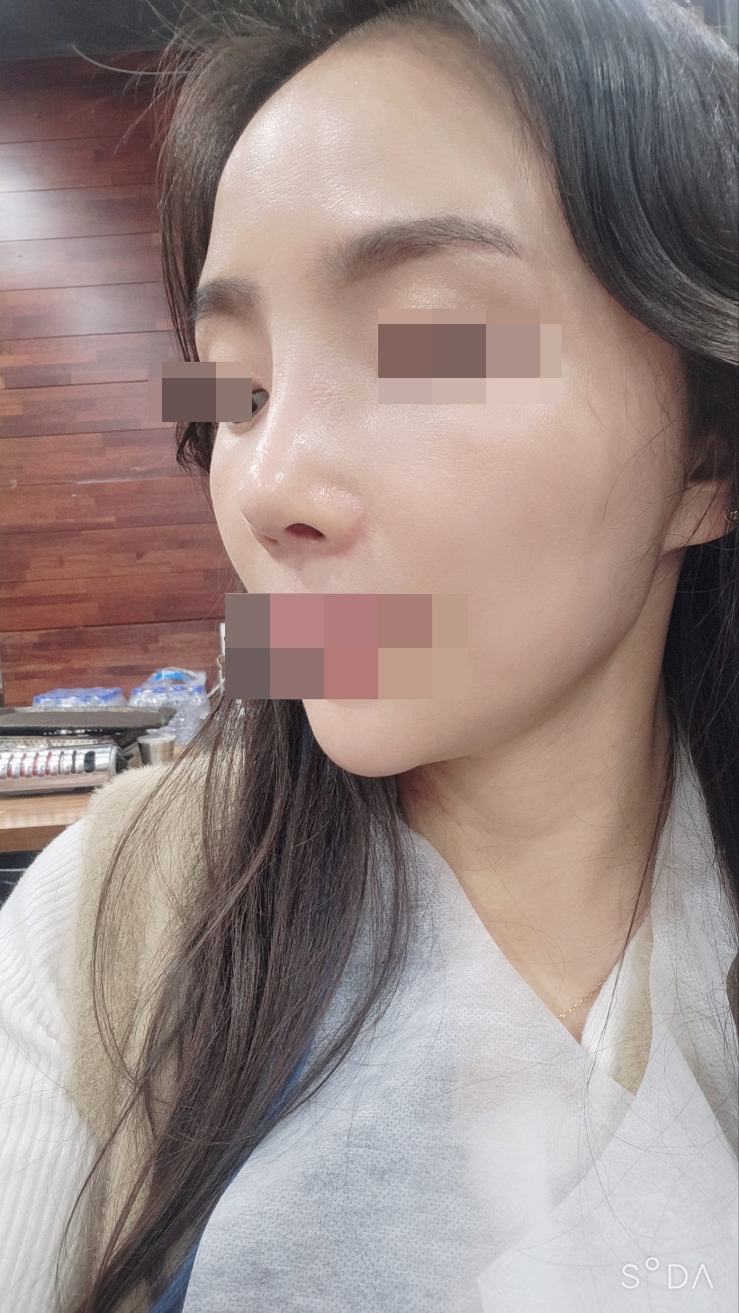 수술후기이미지