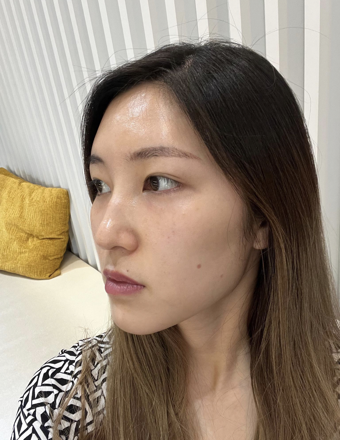 수술후기이미지