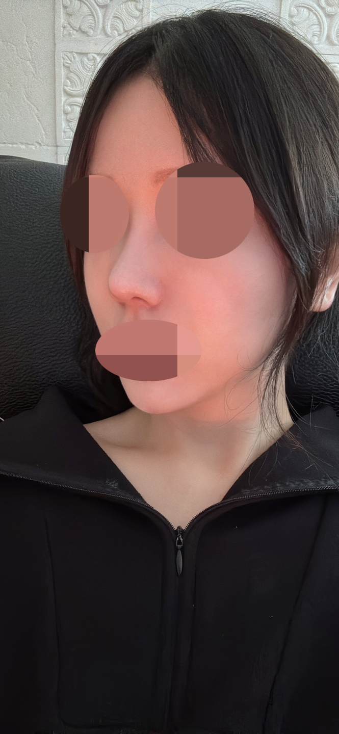 수술후기이미지