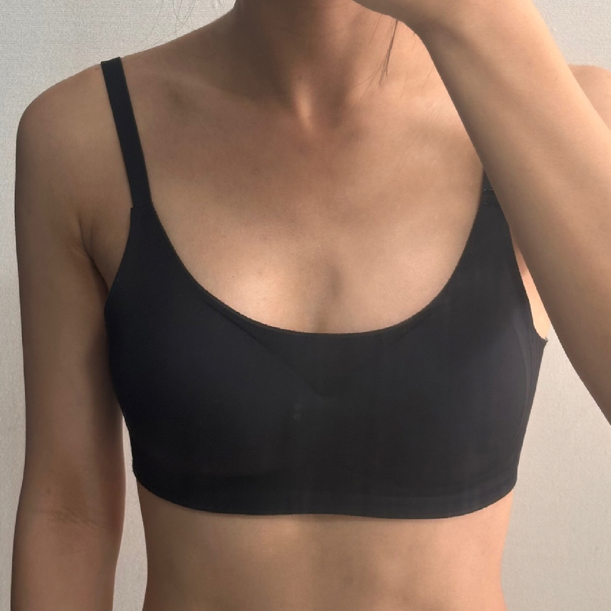 수술후기이미지