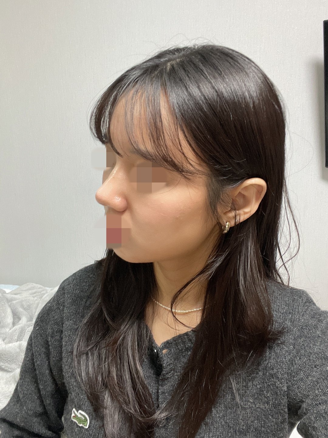 수술후기이미지