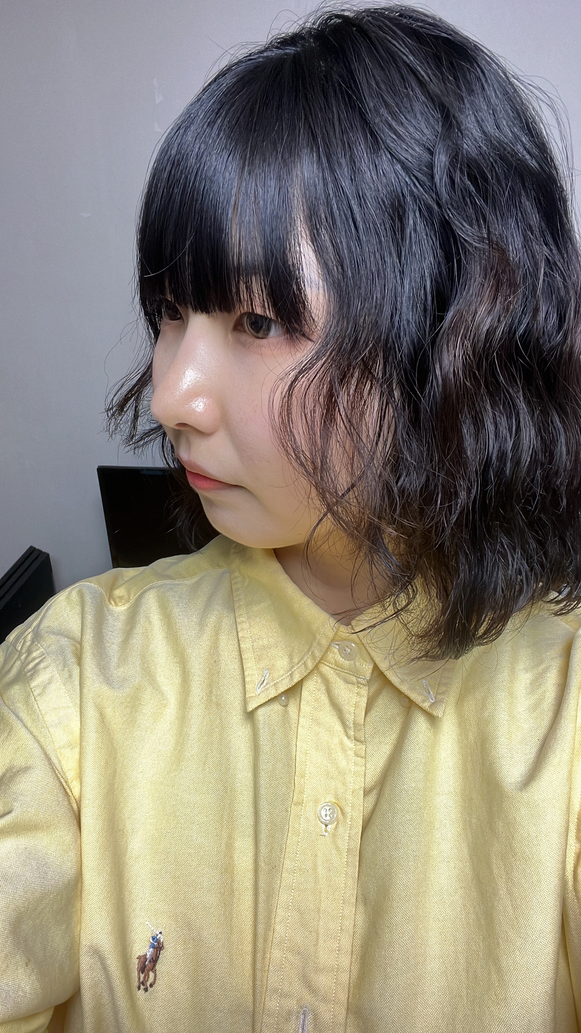 수술후기이미지