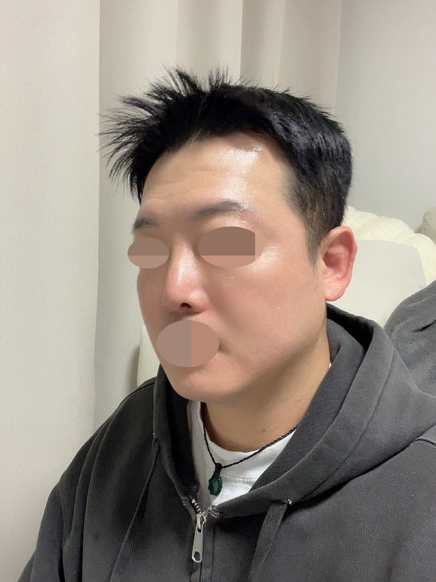 수술후기이미지