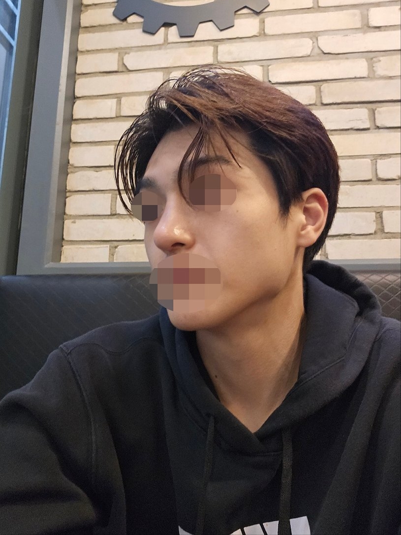 수술후기이미지